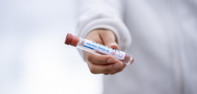 Test tube 5065426 1280